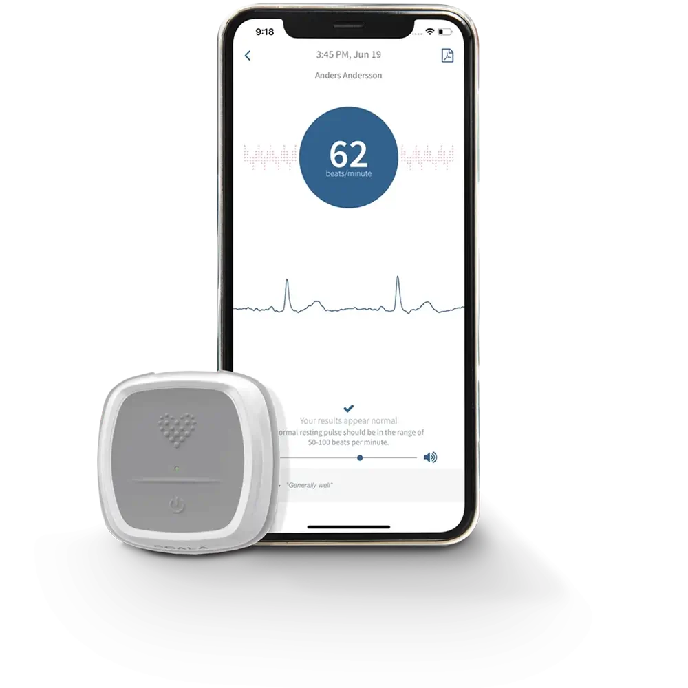 Coala Heart Monitor